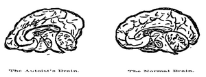 The Automobile Brain